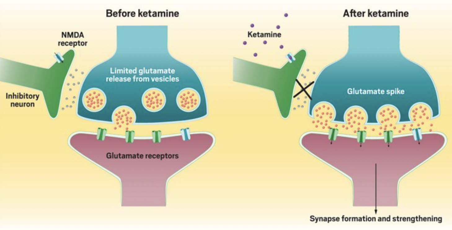 Ketamine Before And After